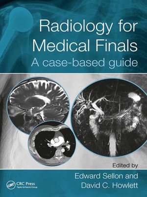 cover image of Radiology for Medical Finals